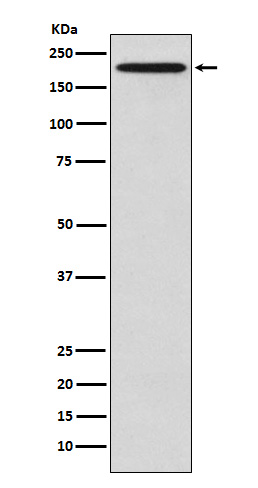 1 - Anti-GCN2 EIF2AK4 Rabbit Monoclonal Antibody ABO14399