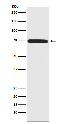 1 - Anti-Menin MEN1 Monoclonal Antibody ABO14409