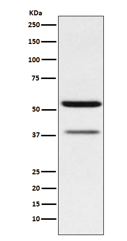 1 - Anti-CEACAM6 Rabbit Monoclonal Antibody ABO14411