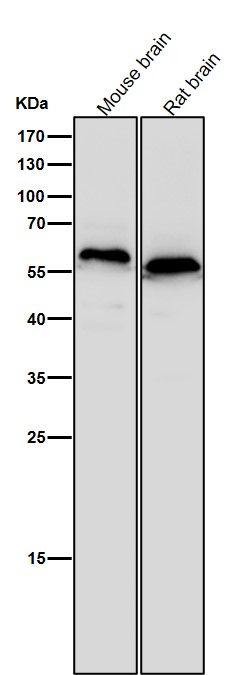 1 - Anti-CEACAM6 Rabbit Monoclonal Antibody ABO14411