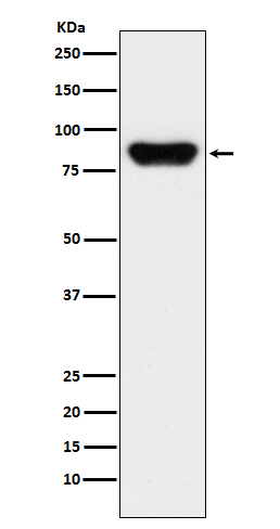 1 - Anti-Prothrombin F2 Monoclonal Antibody ABO14412