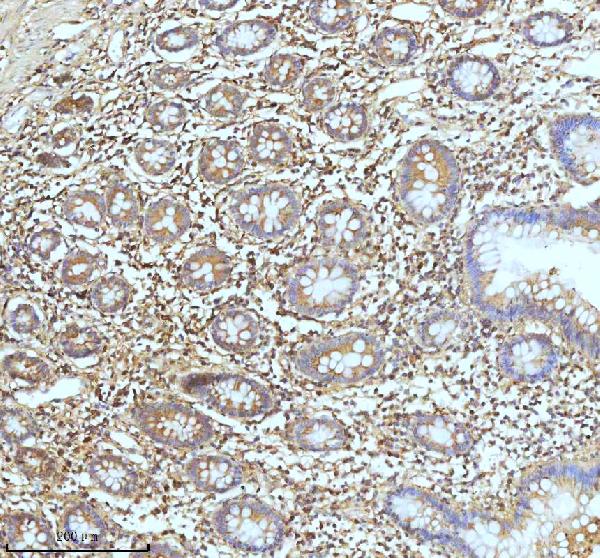 2 - Anti-Ferritin Light Chain FTL Monoclonal Antibody ABO14415