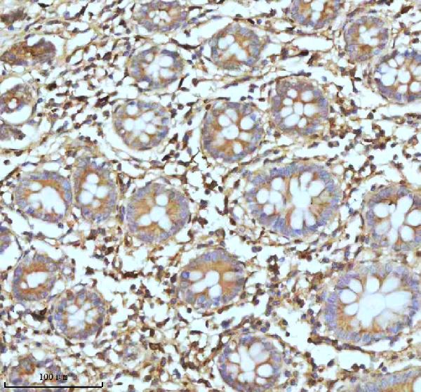 2 - Anti-Ferritin Light Chain FTL Monoclonal Antibody ABO14415