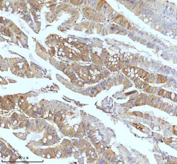 2 - Anti-Ferritin Light Chain FTL Monoclonal Antibody ABO14415