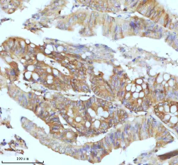 2 - Anti-Ferritin Light Chain FTL Monoclonal Antibody ABO14415