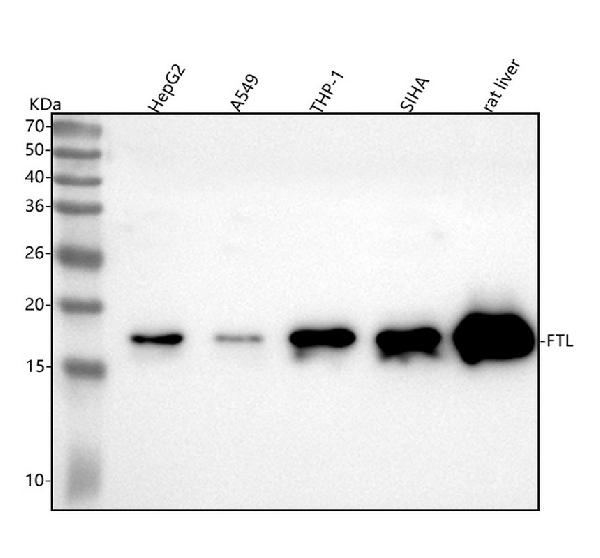1 - Anti-Ferritin Light Chain FTL Monoclonal Antibody ABO14415