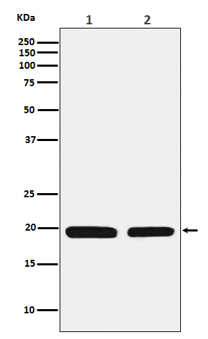 1 - Anti-Ferritin Light Chain FTL Monoclonal Antibody ABO14415