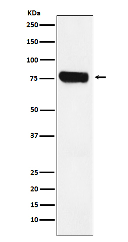 1 - Anti-HEC1 NDC80 Monoclonal Antibody ABO14417