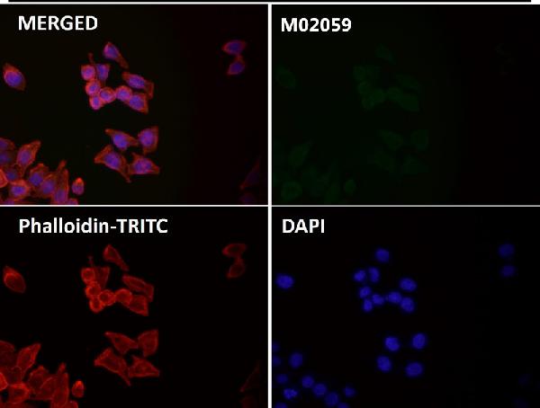 1 - Anti-GPX4 Rabbit Monoclonal Antibody ABO14418