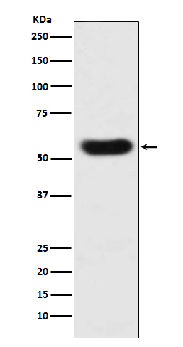 1 - Anti-SERPINC1 Monoclonal Antibody ABO14419