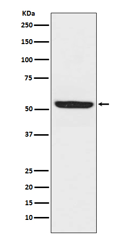 1 - Anti-SPHK1 Monoclonal Antibody ABO14420