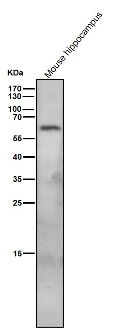 1 - Anti-SPHK1 Monoclonal Antibody ABO14420