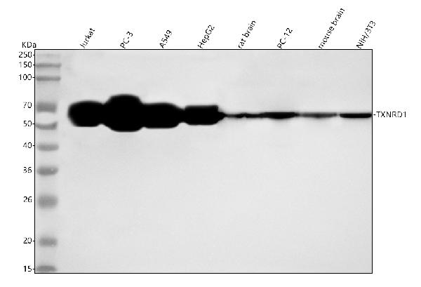 1 - Anti-TXNRD1 Rabbit Monoclonal Antibody ABO14423