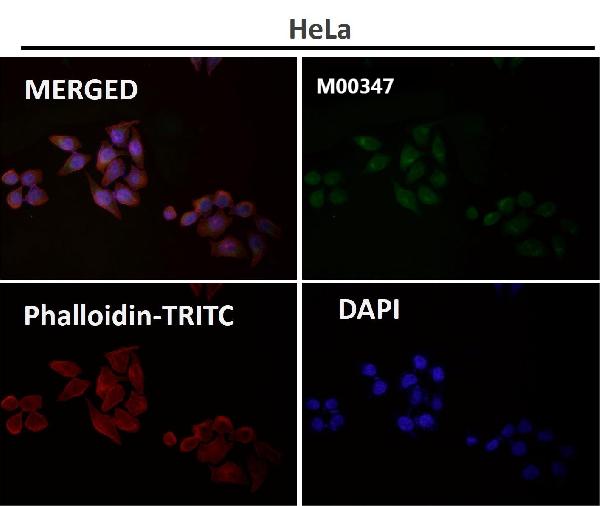 1 - Anti-Rad50 Monoclonal Antibody ABO14425