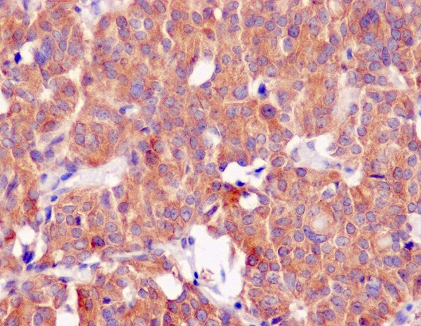 2 - Anti-CLOCK Monoclonal Antibody ABO14426