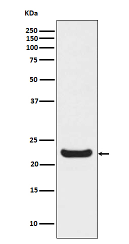 1 - Anti-RBP4 Monoclonal Antibody ABO14431