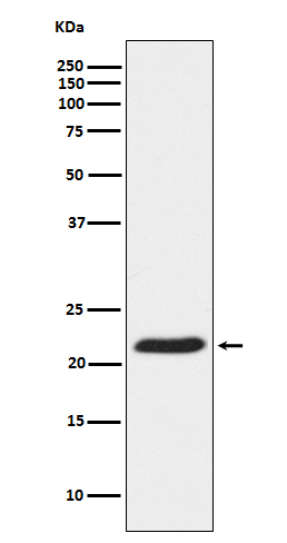 1 - Anti-TCTP Rabbit Monoclonal Antibody ABO14432