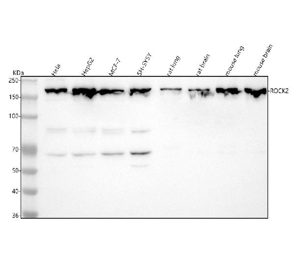 1 - Anti-ROCK2 Monoclonal Antibody ABO14435