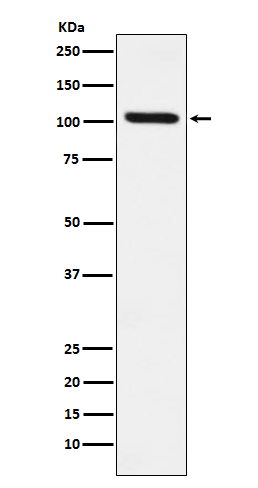 1 - Anti-DDX58 Monoclonal Antibody ABO14438