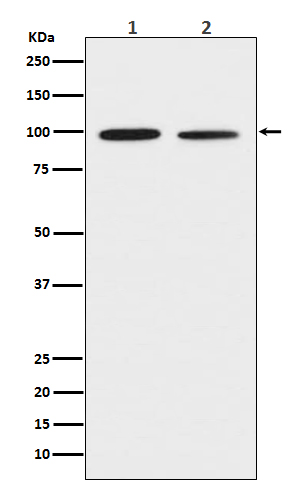 1 - Anti-DDR2 Monoclonal Antibody ABO14439