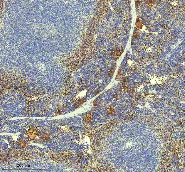 2 - Anti-PF4 Monoclonal Antibody ABO14441