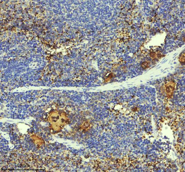 2 - Anti-PF4 Monoclonal Antibody ABO14441