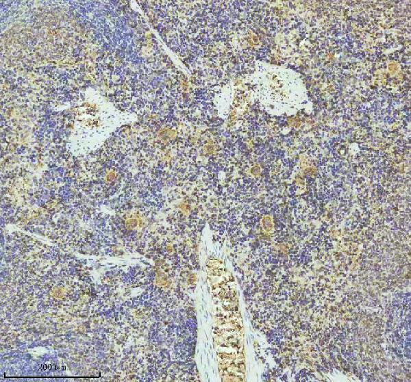 2 - Anti-PF4 Monoclonal Antibody ABO14441