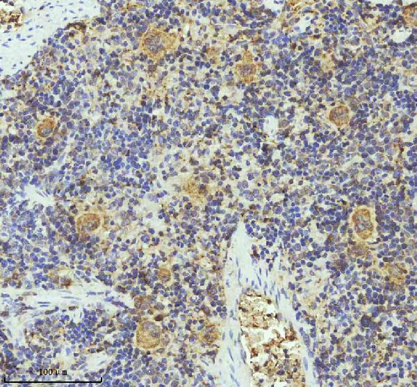 2 - Anti-PF4 Monoclonal Antibody ABO14441