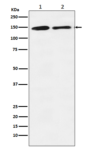 1 - Anti-mSin3A Rabbit Monoclonal Antibody ABO14442