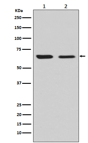 1 - Anti-CRMP2 Rabbit Monoclonal Antibody ABO14445