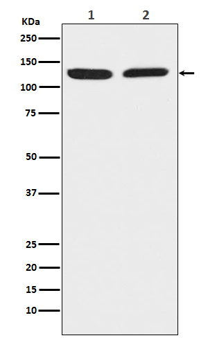 1 - Anti-Chromogranin B CHGB Monoclonal Antibody ABO14454