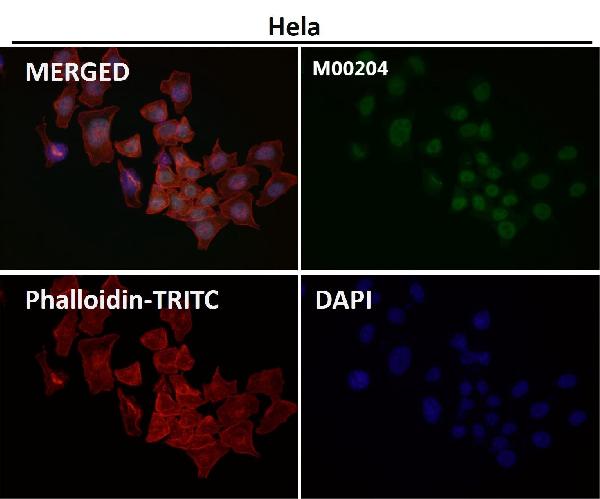 1 - Anti-Ran Monoclonal Antibody ABO14456