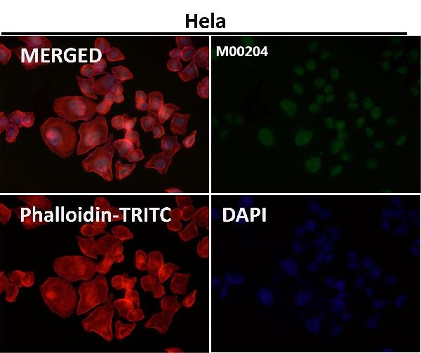 1 - Anti-Ran Monoclonal Antibody ABO14456