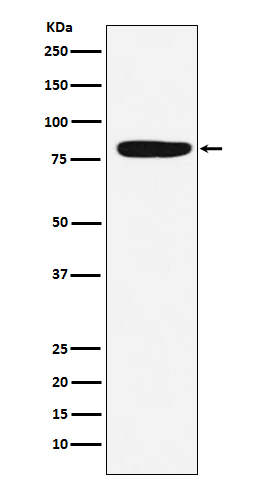 1 - Anti-Factor XIIIa F13A1 Monoclonal Antibody ABO14460