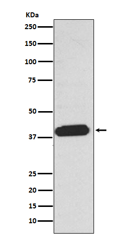 1 - Anti-EDG2 LPAR1 Rabbit Monoclonal Antibody ABO14462