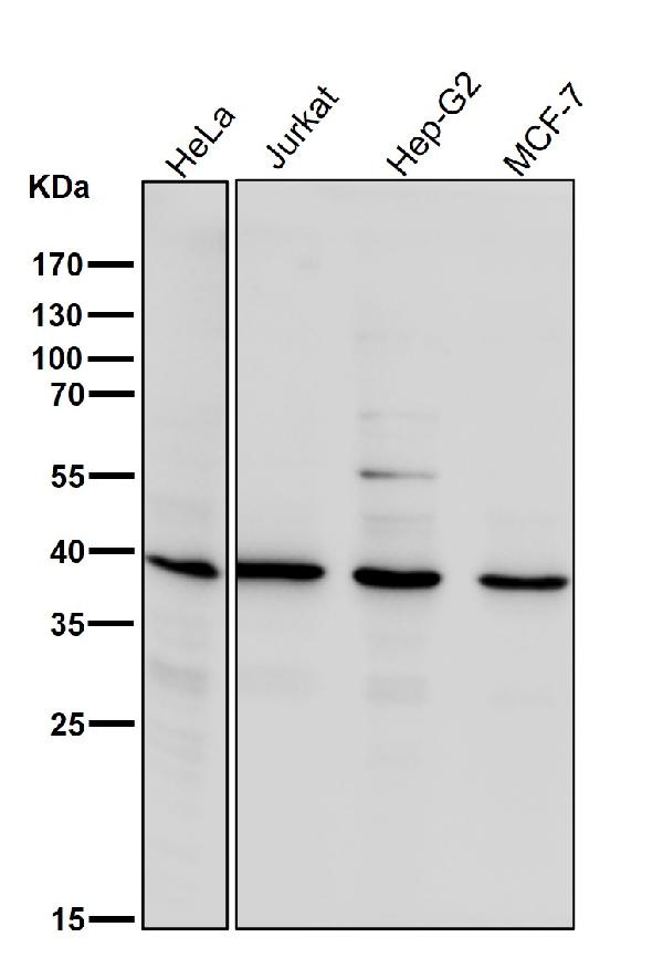 1 - Anti-EDG2 LPAR1 Rabbit Monoclonal Antibody ABO14462