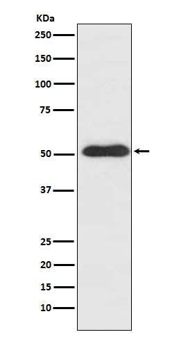 1 - Anti-Slit2 Monoclonal Antibody ABO14463