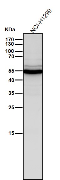 1 - Anti-Slit2 Monoclonal Antibody ABO14463