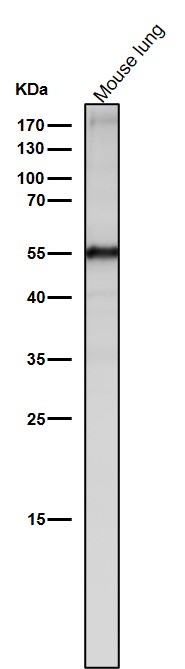 1 - Anti-Slit2 Monoclonal Antibody ABO14463