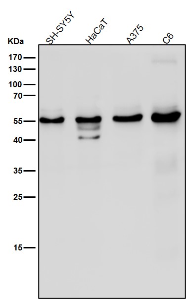 1 - Anti-Slit2 Monoclonal Antibody ABO14463
