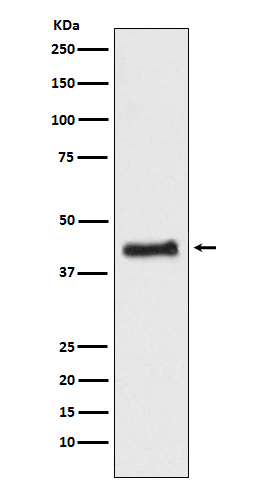 1 - Anti-COUP TF1 NR2F1 Monoclonal Antibody ABO14467