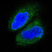 3 - Anti-MAP3K7 Monoclonal Antibody ABO14473