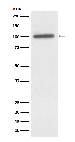 1 - Anti-alpha Actinin 4 ACTN4 Monoclonal Antibody ABO14476