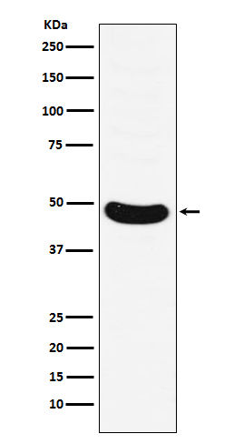 1 - Anti-HB9/HLXB9 Monoclonal Antibody ABO14482