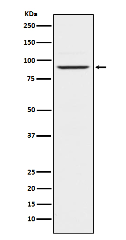 1 - Anti-Prolactin Receptor Rabbit Monoclonal Antibody ABO14483