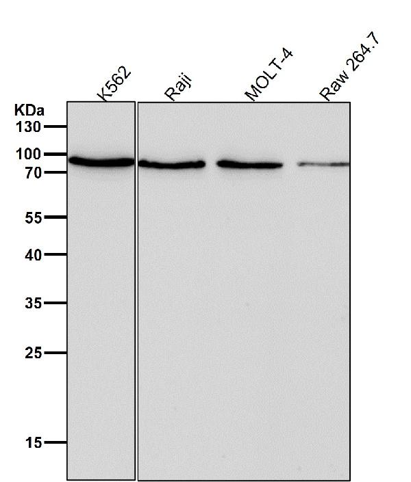 1 - Anti-Prolactin Receptor Rabbit Monoclonal Antibody ABO14483