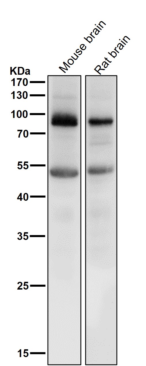 1 - Anti-Prolactin Receptor Rabbit Monoclonal Antibody ABO14483