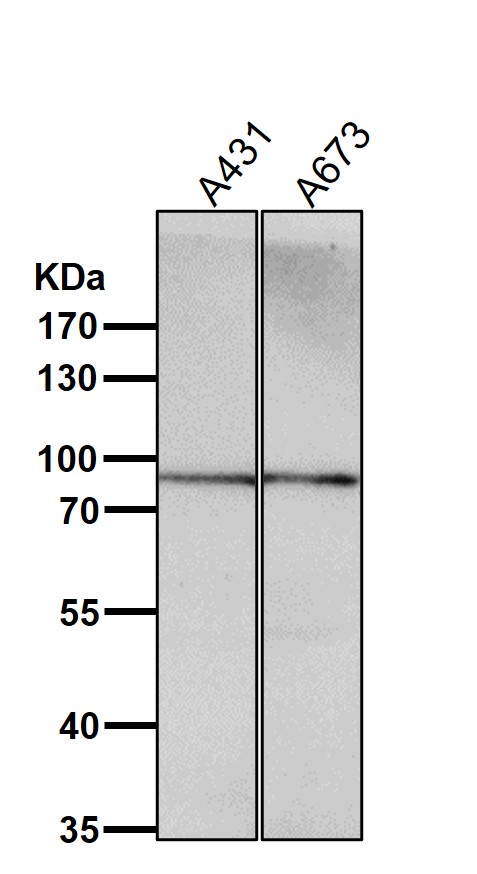 1 - Anti-Prolactin Receptor Rabbit Monoclonal Antibody ABO14483