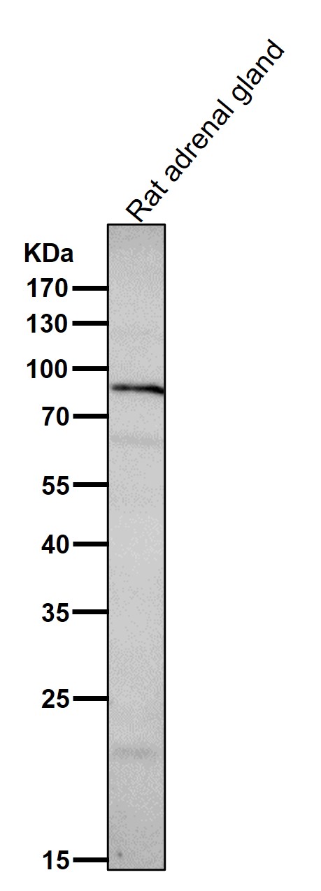 1 - Anti-Prolactin Receptor Rabbit Monoclonal Antibody ABO14483