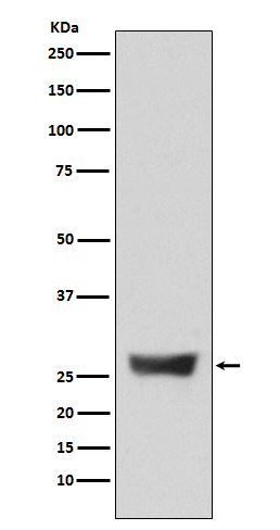 1 - Anti-NDUFS3 Monoclonal Antibody ABO14484